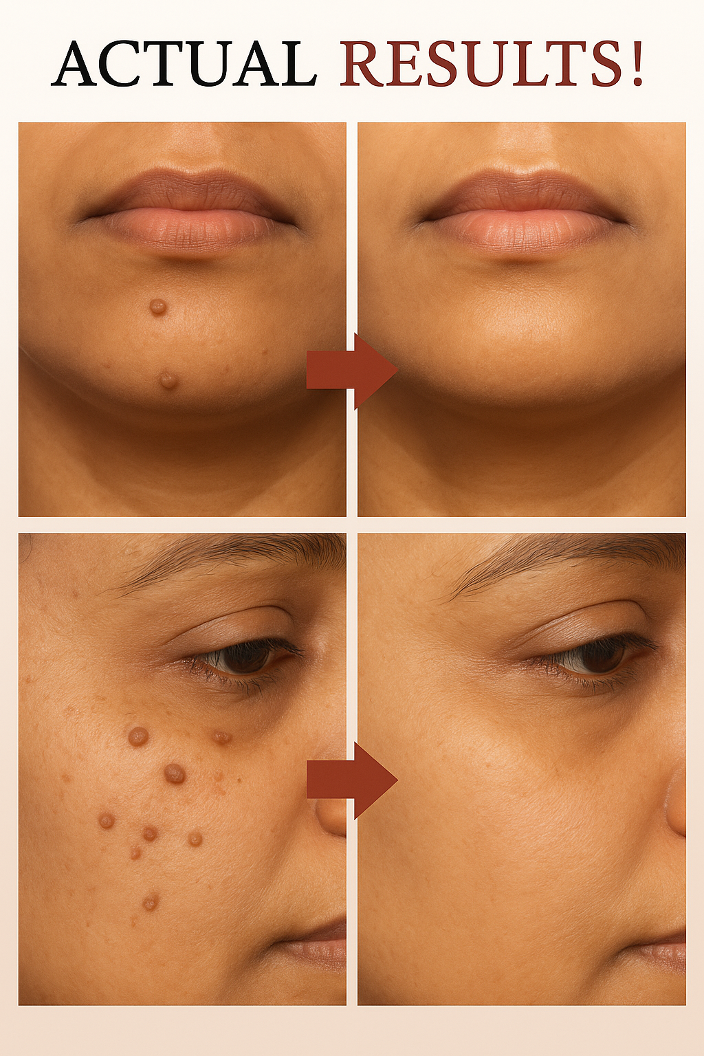 ✨ Tag & Mole Remover Pen 🔥 – Clear Skin in 5 Days! 🌿 Buy 1 Get 1 FREE 💥